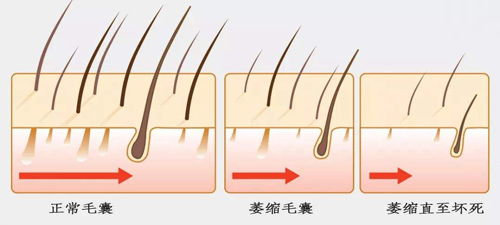 如何改善掉头发