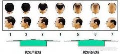 倍生植发价格=数量X单价，这个数学题很简单